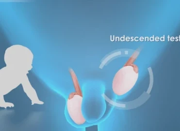 İnmemiş Testis (Kriptorşidizm) Nedir? Ne Zaman Ameliyat Gerekir?