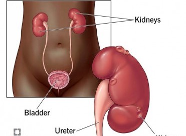 Böbrek Kistleri: Zararsız mı, Tedavi Gerekli mi?