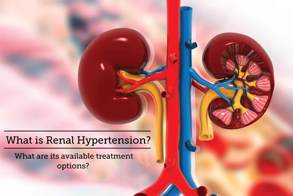 Hipertansiyonun Böbreklere Etkisi: Renal Hipertansiyon Nedir?