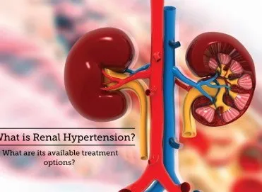 Hipertansiyonun Böbreklere Etkisi: Renal Hipertansiyon Nedir?