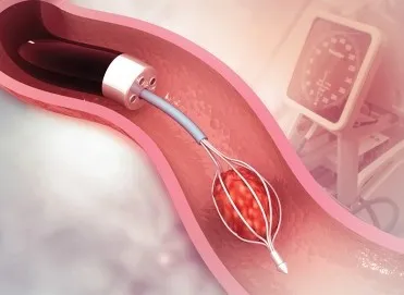 RIRS Nedir? Böbrek Taşında Lazer ile Kapalı Tedavi