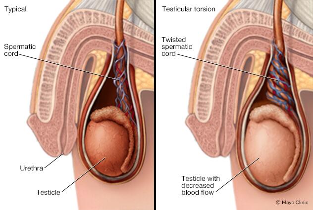 Erkeklerde Testis Ağrısı: Nedenleri ve Ne Zaman Doktora Gitmeli?